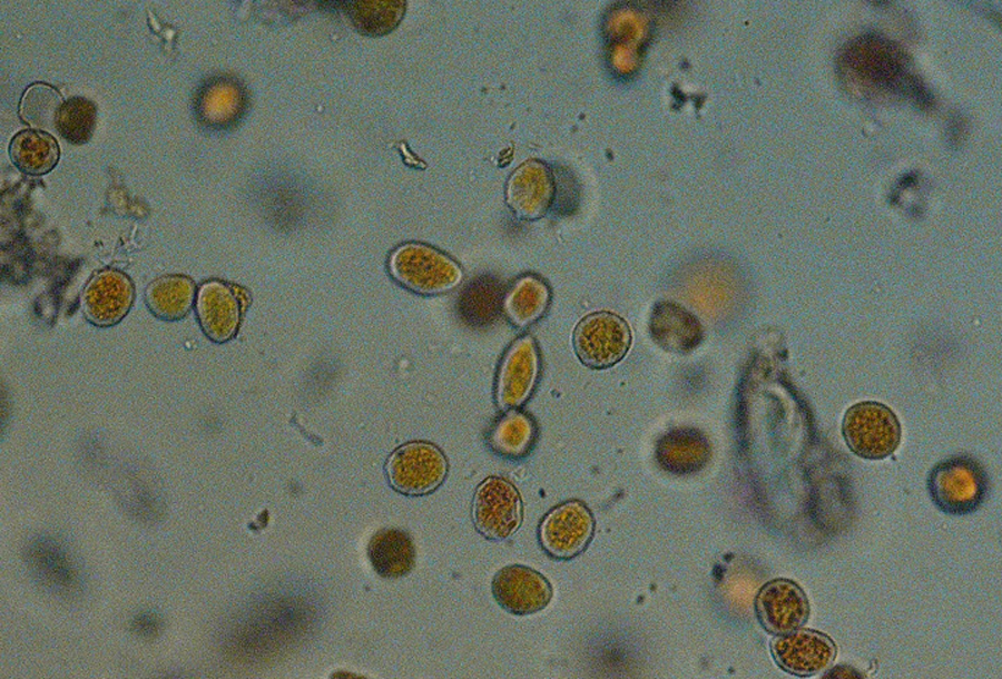 Figure 1a. Urediniospores of P. striiformis = 10x